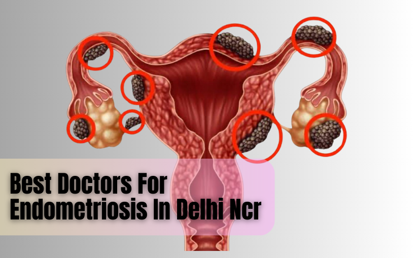 Best Doctors For Endometriosis In Delhi Ncr